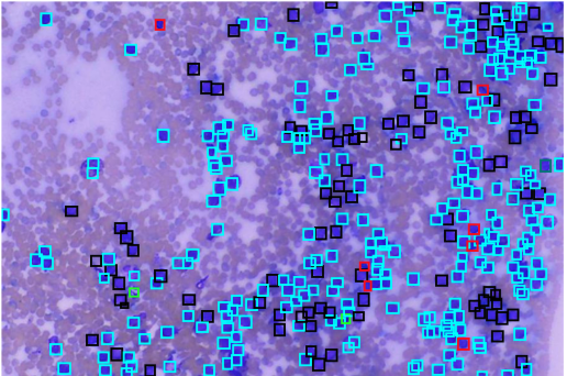 AI Lymphoma Cytology